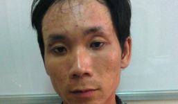 Nhân viên nhà xác bệnh viện bị đánh chết vì thiếu nợ 500.000 đồng